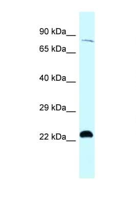 Polyclonal Rabbit anti-Human RPS6KA4 / MSK2 / RSK-B Antibody (C-Terminus, WB)