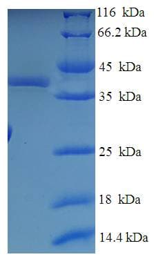 Human NABP1 / OBFC2A Protein (Recombinant His-SUMO)