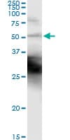 KRT18 / CK18 / Cytokeratin 18 Antibody (clone 2F8)