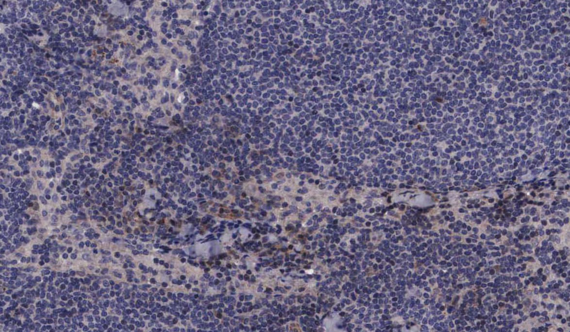 Polyclonal Rabbit anti-Human MAP2K3 / MEK3 / MKK3 Antibody (phospho-Ser189, IHC, IF, WB)