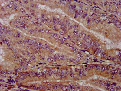 Polyclonal Rabbit anti-Human PPP2R4 Antibody (IHC, WB)
