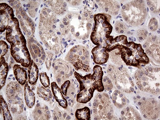 Monoclonal Mouse anti-Human GNAS Antibody (clone OTI13G5, IHC, WB)