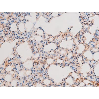 Polyclonal Rabbit anti-Human RELA / NFKB p65 Antibody (phospho-Thr435, IHC, IF, WB)