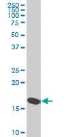 RPS23 / Ribosomal Protein S23 Antibody (clone 1E3)
