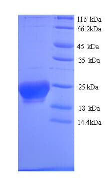 Human ASAH2B Protein (Recombinant His)