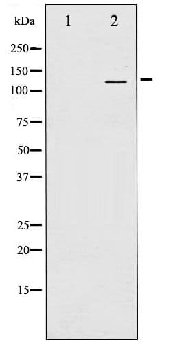 GRIN1 / NMDAR1 Antibody (phospho-Ser897)