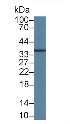 UCP2 Antibody (aa154-289, PE)