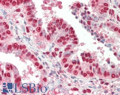 Polyclonal Rabbit anti-Human IRX3 Antibody (aa386-435, IHC, WB)