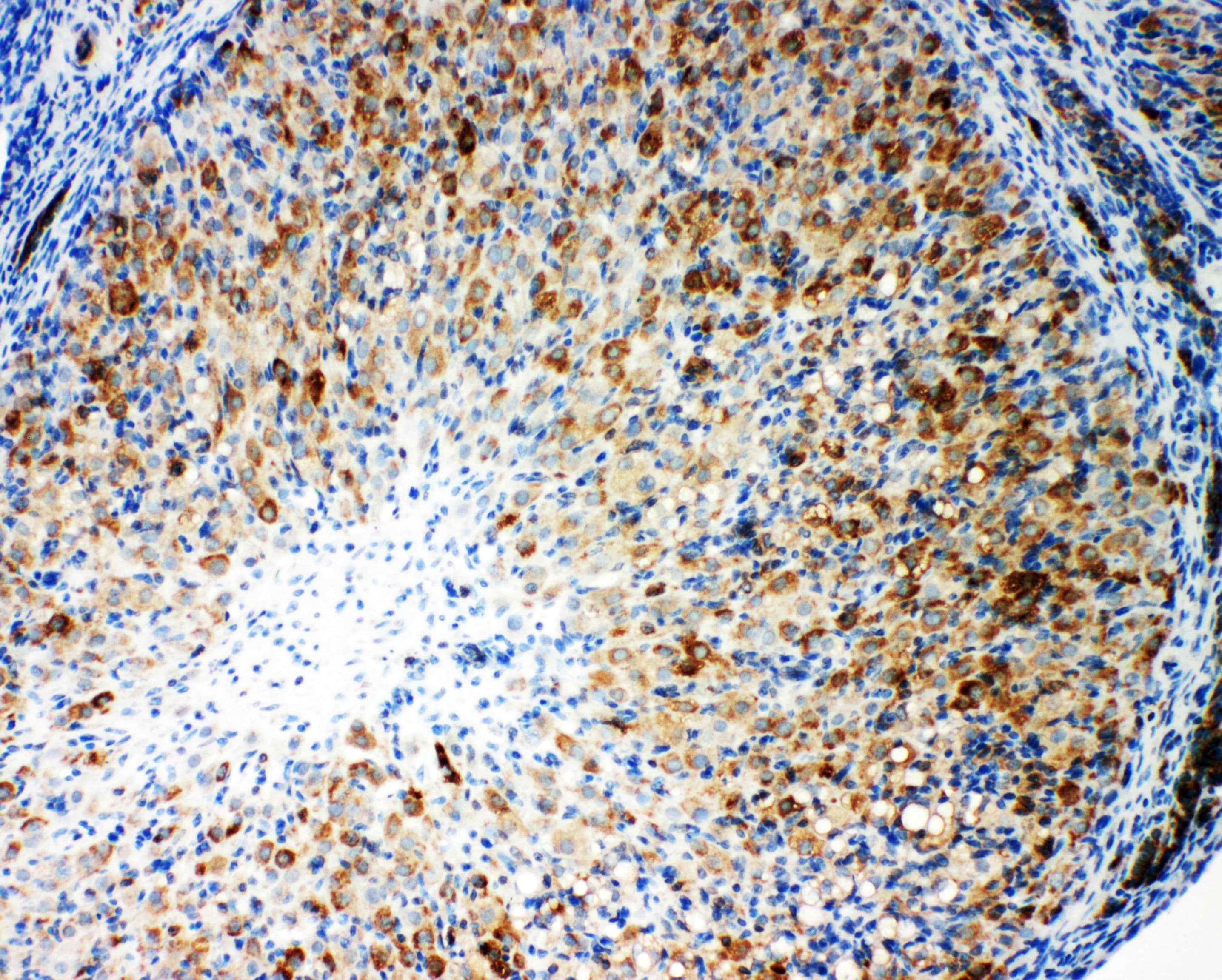 Polyclonal Rabbit anti-Human CYPOR / POR Antibody (aa659-677, IHC, WB)
