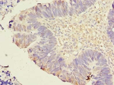 Polyclonal Rabbit anti-Human TMEM59L Antibody (IHC, WB)