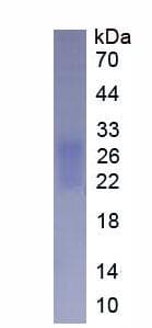 Human FNDC5 / Irisin Protein (Recombinant His, N-Terminal)