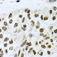Polyclonal Rabbit anti-Human CTCF Antibody (IHC, WB)
