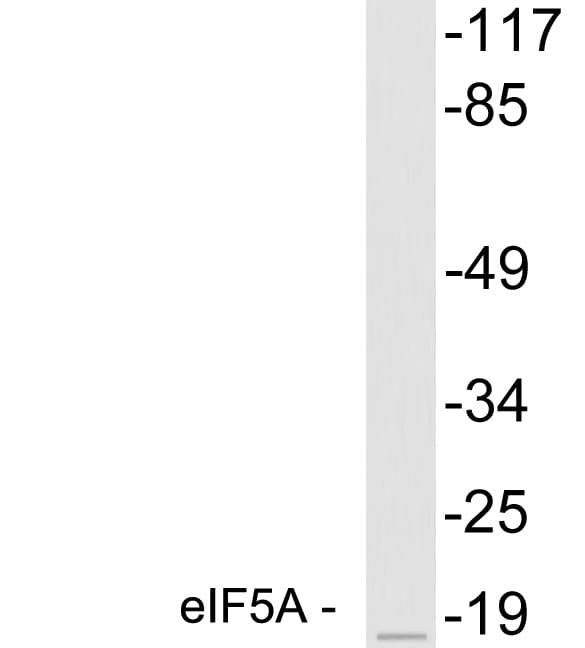 EIF5A Antibody (aa79-128)