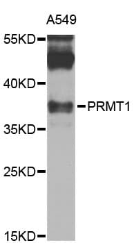Polyclonal Rabbit anti-Human PRMT1 Antibody (IHC, WB)