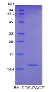 Human HIST2H2AC Protein (Recombinant His)