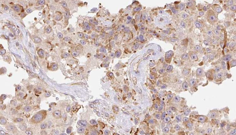 LL37 / Cathelicidin Antibody