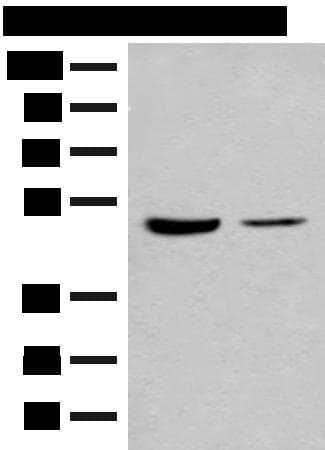 IL7R / CD127 Antibody
