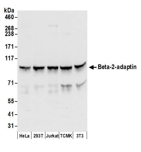 AP2B1 Antibody (aa575-625)