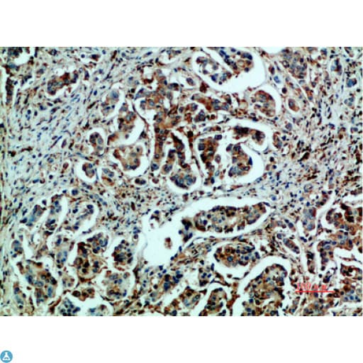 Polyclonal Rabbit anti-Human HSPA5 / GRP78 / BiP Antibody (WB)
