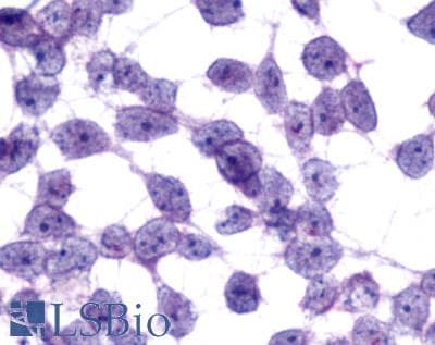 IHC-plus™ Polyclonal Rabbit anti-Human MCHR2 Antibody (C-Terminus, IHC)