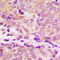 Polyclonal Rabbit anti-Human HSP90AA1 / Hsp90 Alpha A1 Antibody (C-Terminus, IHC, IF, WB)