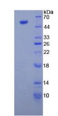 Human TUBB3 / Tubulin Beta 3 Protein (Recombinant His-GST)