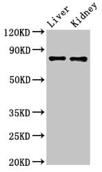 Polyclonal Rabbit anti-Human SLC22A23 Antibody (IHC, WB)