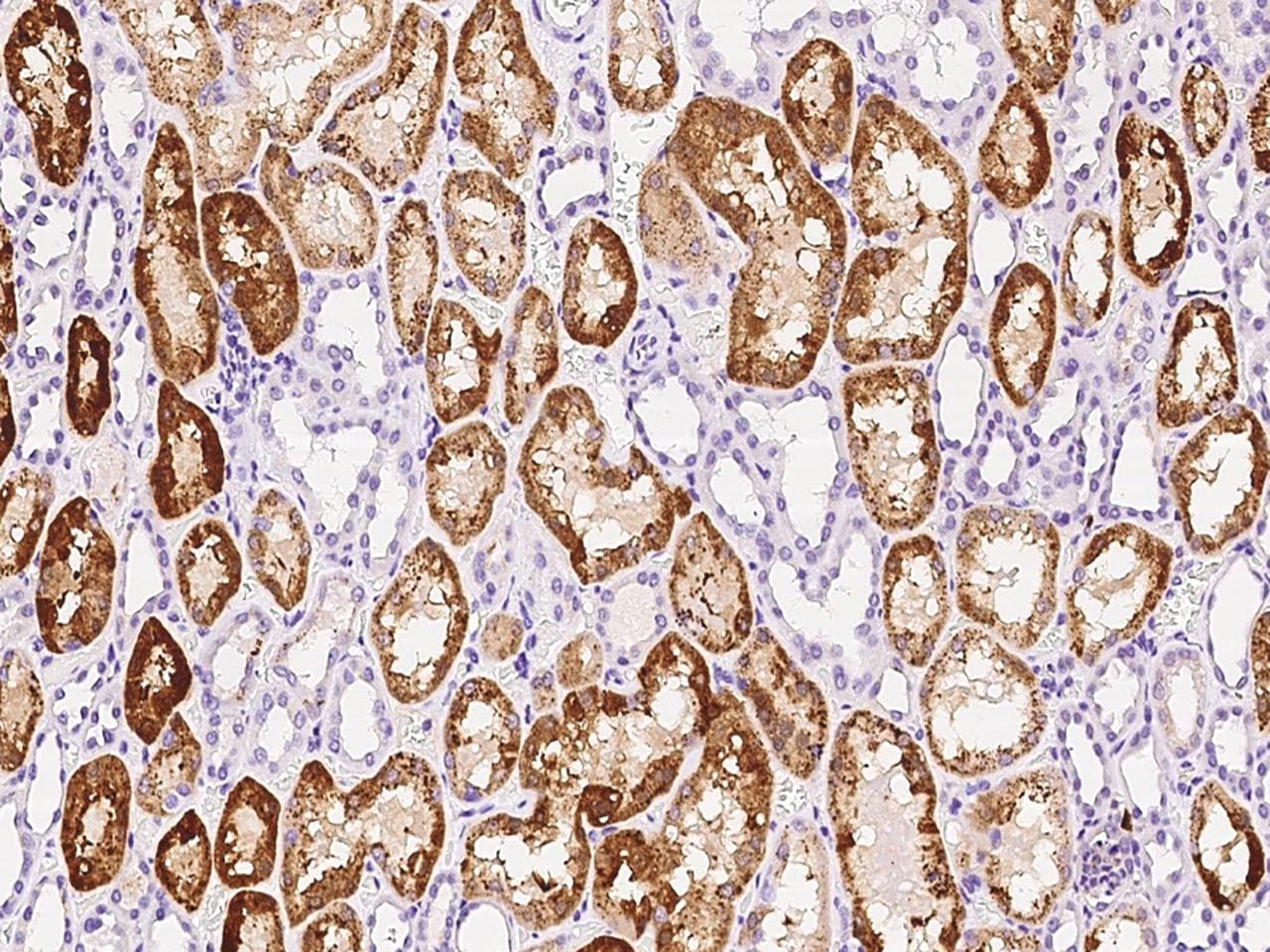GM2A Antibody (Preservative Free)