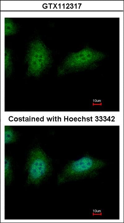 ZNHIT2 Antibody