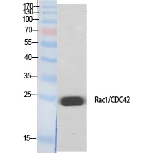 Polyclonal Rabbit anti-Human RAC1+2+3 + CDC42 Antibody (10-90 aa, IHC, WB)