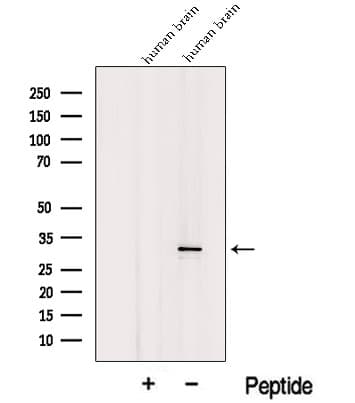 Polyclonal Rabbit anti-Human ICMT / PPMT Antibody (WB)
