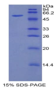 Mouse HGFAC / HGFA Protein (Recombinant His-GST)
