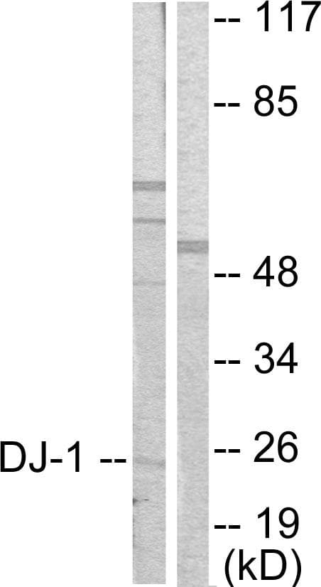Polyclonal Rabbit anti-Human PARK7 / DJ-1 Antibody (IHC, IF, WB)
