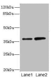 Polyclonal Rabbit anti-Human CLYBL Antibody (IHC, WB)
