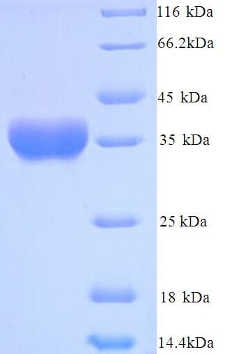 Staphylococcus aureus hly / Alpha-Hemolysin Protein (Recombinant 6His, N-terminus)