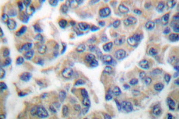 EEF2K Antibody (Pro360)