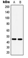 HTR1A / 5-HT1A Receptor Antibody (C-Terminus)