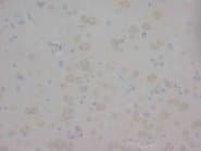 CHRNA1 Antibody (N-Terminus)