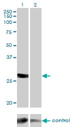 DGUOK / Deoxyguanosine Kinase Antibody (clone 3E9)