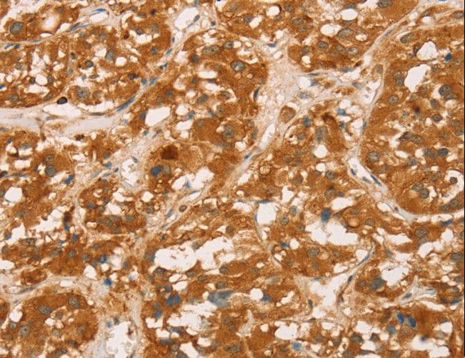 SPN / CD43 Antibody