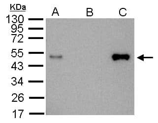 Polyclonal Rabbit anti-Human LDB1 / CLIM2 Antibody (aa86-411, IHC, WB)