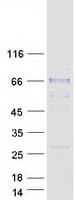 Human SIAE Protein (Recombinant Myc-DDK (Flag))