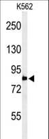 PLA2G4B Antibody (aa396-424)