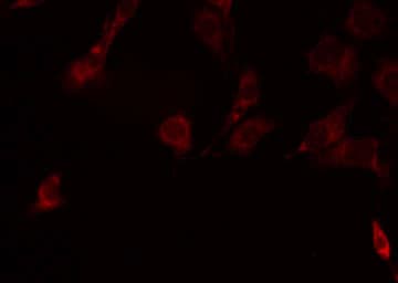 TNFRSF19L / RELT Antibody