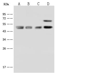 FH / Fumarase / MCL Antibody
