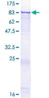 Human SYK Protein (Recombinant GST)