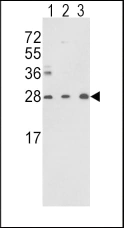 TPI1 / TPI Antibody (aa68-96)