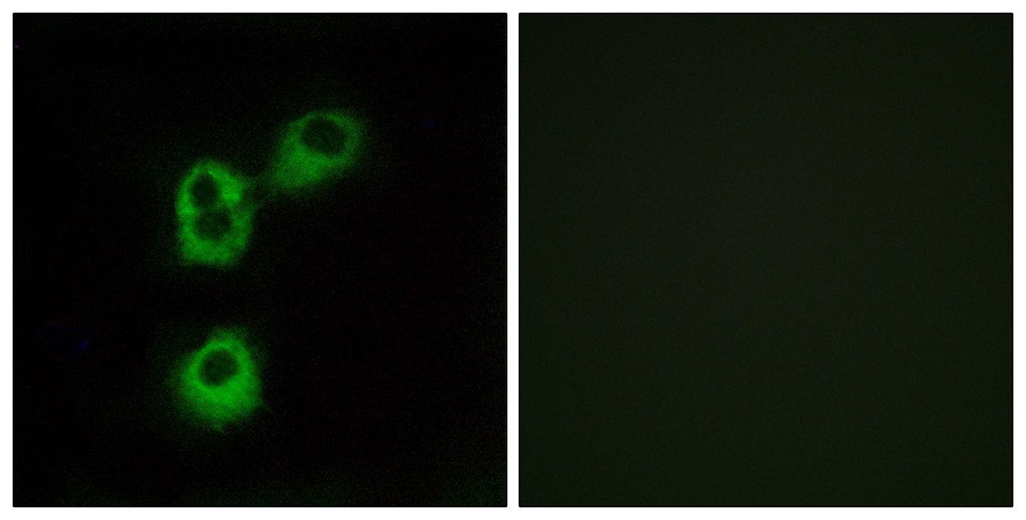 OR5M1 Antibody