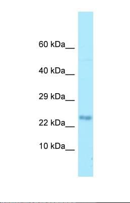 Polyclonal Rabbit anti-Human MOBP Antibody (N-Terminus, WB)