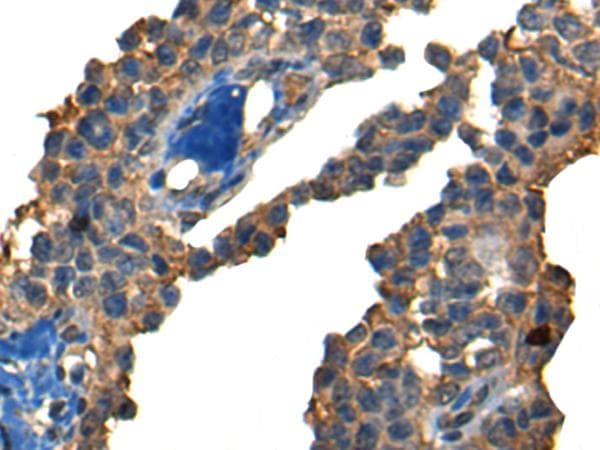Polyclonal Rabbit anti-Human DNAJC2 / ZRF1 Antibody (IHC)